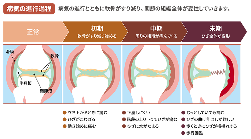 治療の流れ